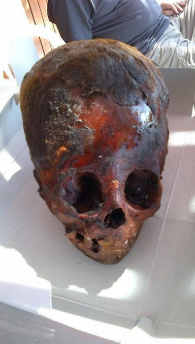 Baby Elongated Skull From Peru
