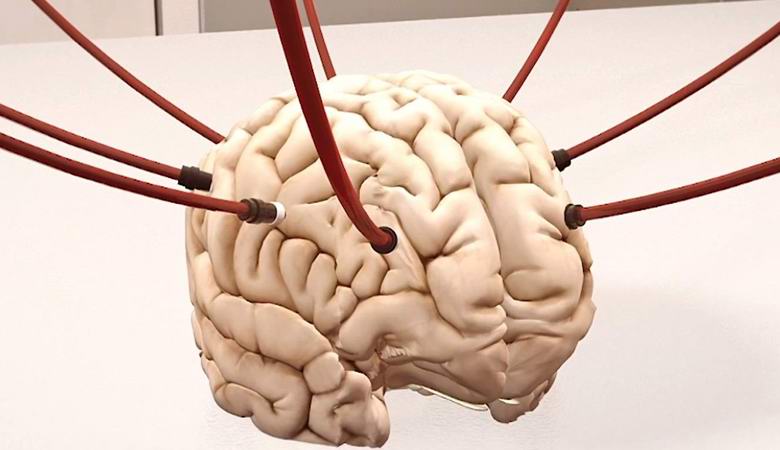 Ethical debate flared up after scientists supported life in the brains of decapitated pigs