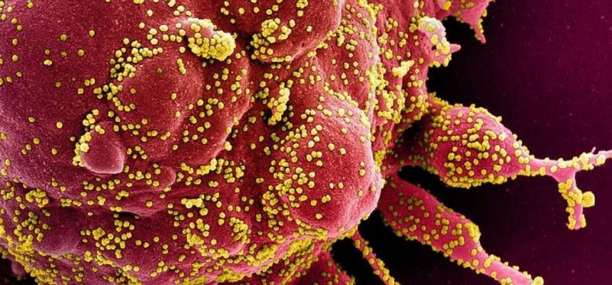 Study Shows COVID-19 Could Force Immune Systems To Attack Themselves 