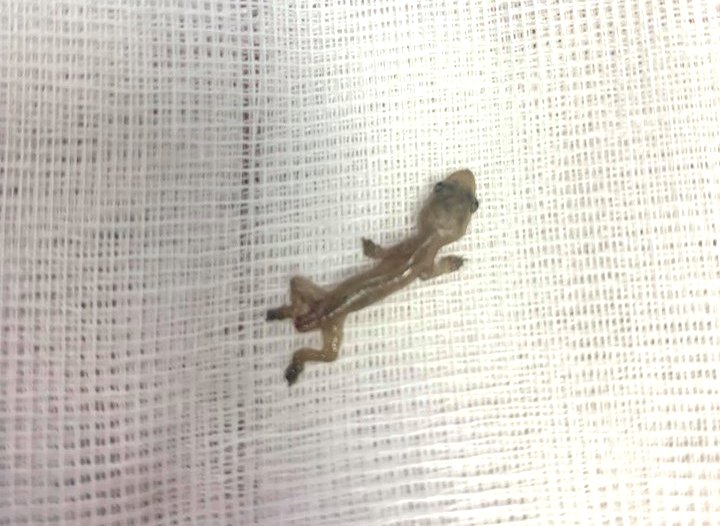 The tiny lizard managed to live in the man’s ear for two days