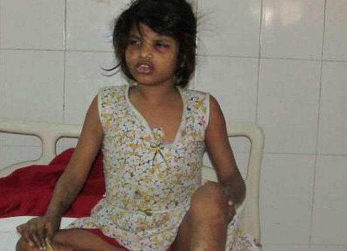 Found 8-year-old Mowgli girl raised by monkeys