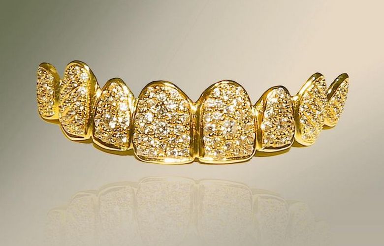 The most expensive dentures in the world