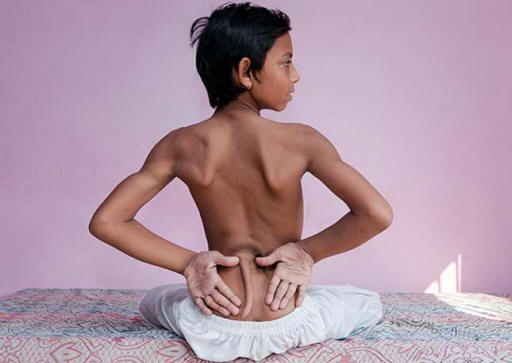 In India, a boy with a tail is recognized as the embodiment of a deity