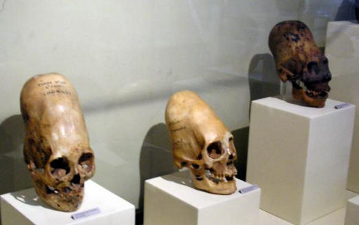 The elongated skulls from the Paracas desert turned out to have strange DNA.