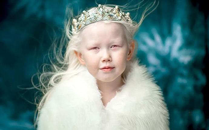 Yakut albino girl charmed the Internet