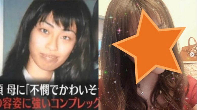 A woman made plastic surgery the meaning of life, because in childhood, her mother called her an ugly girl.